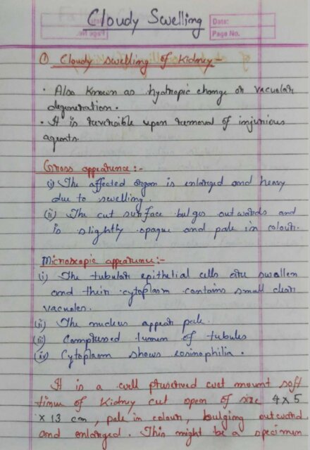 •Gross and Histopathology• Image based Handwritten notes with identification points - Pathology (2nd Year MBBS)