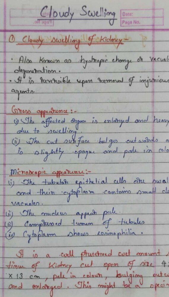 •Gross and Histopathology• Image based Handwritten notes with identification points - Pathology (2nd Year MBBS)