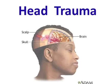 Head Trauma and its Management Notes (MS Word File)