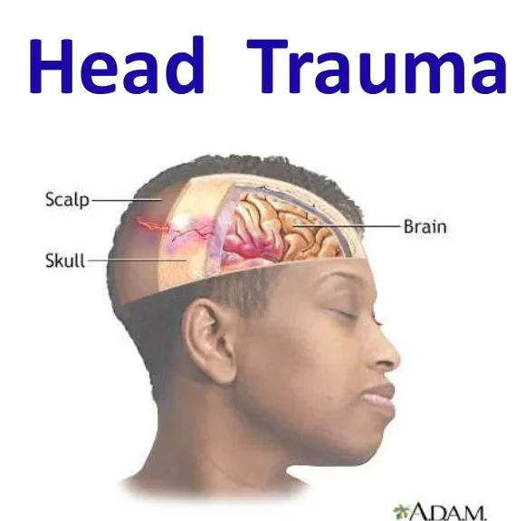 Head Trauma and its Management Notes (MS Word File)